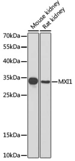 Invitrogen MXI1 Polyclonal Antibody 100 &mu;L; Unconjugated:Antibodies,