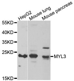 Invitrogen MYL3 Polyclonal Antibody 100 &mu;L; Unconjugated:Antibodies,