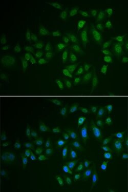 Invitrogen MLCK Polyclonal Antibody 100 &mu;L; Unconjugated:Antibodies,