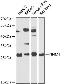 Invitrogen NNMT Polyclonal Antibody 100 &mu;L | Buy Online | Invitrogen&trade; | Fisher Scientific