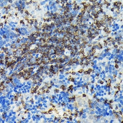 Invitrogen PIK3CG Polyclonal Antibody 100 &mu;L; Unconjugated:Antibodies,