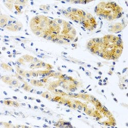 Invitrogen PROK2 Polyclonal Antibody 100 &mu;L; Unconjugated:Antibodies,