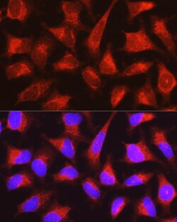 Invitrogen PYGL Polyclonal Antibody 100 &mu;L; Unconjugated:Antibodies,