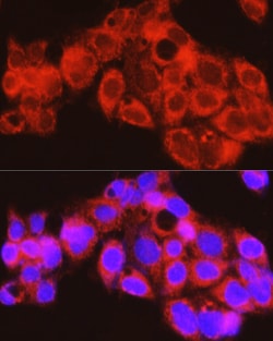 Invitrogen PYGL Polyclonal Antibody 100 &mu;L; Unconjugated:Antibodies,
