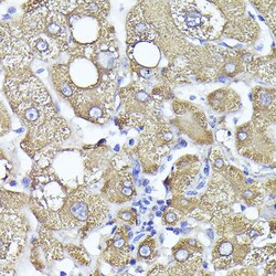 Invitrogen PYGL Polyclonal Antibody 100 &mu;L; Unconjugated:Antibodies,