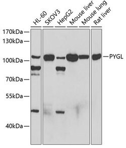 Invitrogen PYGL Polyclonal Antibody 100 &mu;L; Unconjugated:Antibodies,