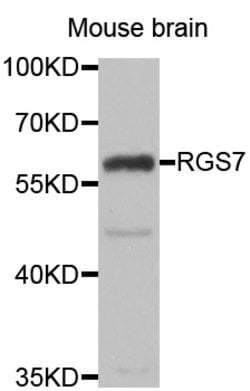 Invitrogen RGS7 Polyclonal Antibody 100 &mu;L; Unconjugated:Antibodies,