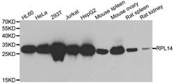 Invitrogen RPL14 Polyclonal Antibody 100 &mu;L; Unconjugated:Antibodies,