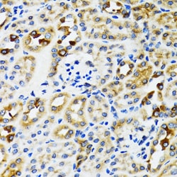 Invitrogen Ribophorin I Polyclonal Antibody 100 &mu;L; Unconjugated:Antibodies,