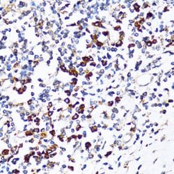 Invitrogen Ribophorin I Polyclonal Antibody 100 &mu;L; Unconjugated:Antibodies,