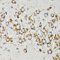 Invitrogen Ribophorin I Polyclonal Antibody 100 &mu;L; Unconjugated:Antibodies,