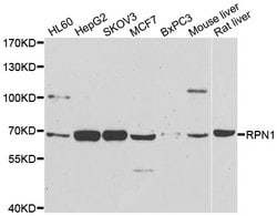 Invitrogen Ribophorin I Polyclonal Antibody 100 &mu;L; Unconjugated:Antibodies,