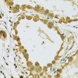 Invitrogen RPS7 Polyclonal Antibody 100 &mu;L; Unconjugated:Antibodies,
