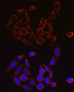 Invitrogen SBP2 Polyclonal Antibody 100 &mu;L; Unconjugated:Antibodies,