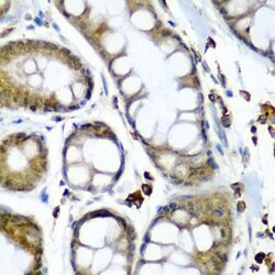 Invitrogen SBP2 Polyclonal Antibody 100 &mu;L; Unconjugated:Antibodies,