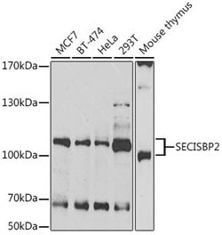Invitrogen SBP2 Polyclonal Antibody 100 &mu;L; Unconjugated:Antibodies,