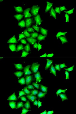 Invitrogen MSRB1 Polyclonal Antibody 100 &mu;L; Unconjugated:Antibodies,