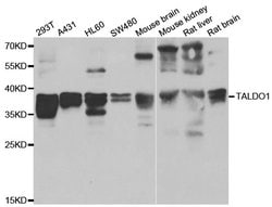 Invitrogen TALDO1 Polyclonal Antibody 100 &mu;L; Unconjugated:Antibodies,