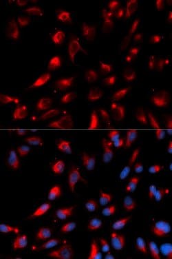 Invitrogen Carboxypeptidase E Polyclonal Antibody 100 &mu;L; Unconjugated:Antibodies,