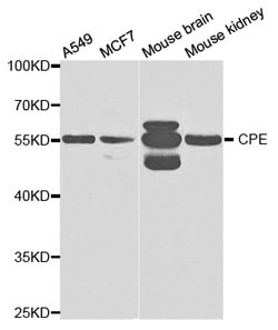 Invitrogen Carboxypeptidase E Polyclonal Antibody 100 &mu;L; Unconjugated:Antibodies,