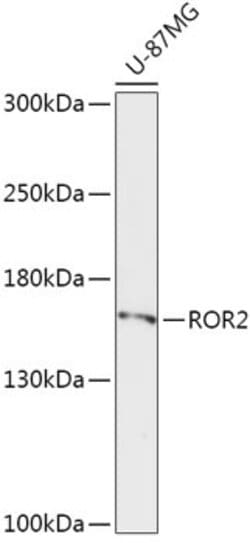 Invitrogen&trade;&nbsp;ROR2 Polyclonal Antibody