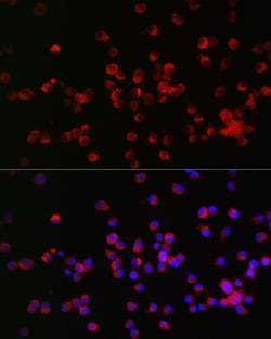 Invitrogen Nogo Receptor Polyclonal Antibody 100 &mu;L; Unconjugated:Antibodies,