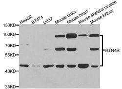 Invitrogen Nogo Receptor Polyclonal Antibody 100 &mu;L; Unconjugated:Antibodies,