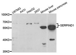 Invitrogen Heparin Cofactor II Polyclonal Antibody 100 &mu;L; Unconjugated:Antibodies,