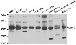 Invitrogen DHPS Polyclonal Antibody 100 &mu;L; Unconjugated:Antibodies,