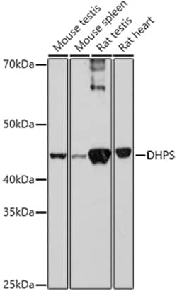 Invitrogen DHPS Polyclonal Antibody 100 &mu;L; Unconjugated:Antibodies,