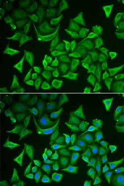 Invitrogen DTYMK Polyclonal Antibody 100 &mu;L; Unconjugated:Antibodies,