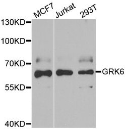 Invitrogen GRK6 Polyclonal Antibody 100 &mu;L | Buy Online | Invitrogen&trade; | Fisher Scientific