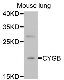 Invitrogen Cytoglobin Polyclonal Antibody 100 &mu;L | Buy Online | Invitrogen&trade; | Fisher Scientific