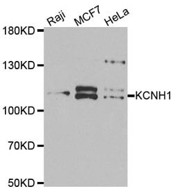 Invitrogen KCNH1 Polyclonal Antibody 100 &mu;L | Buy Online | Invitrogen&trade; | Fisher Scientific