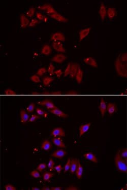 Invitrogen NPHP1 Polyclonal Antibody 100 &mu;L | Buy Online | Invitrogen&trade; | Fisher Scientific