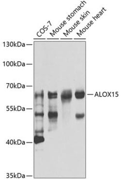 Invitrogen ALOX15 Polyclonal Antibody 100 &mu;L; Unconjugated:Antibodies,