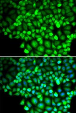 Invitrogen ALOX15B Polyclonal Antibody 100 &mu;L; Unconjugated:Antibodies,