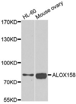 Invitrogen ALOX15B Polyclonal Antibody 100 &mu;L; Unconjugated:Antibodies,