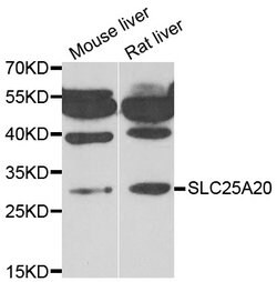 Invitrogen SLC25A20 Polyclonal Antibody 100 &mu;L; Unconjugated:Antibodies,