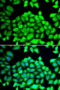 Invitrogen CLCN7 Polyclonal Antibody 100 &mu;L; Unconjugated:Antibodies,