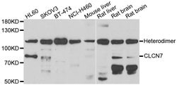 Invitrogen CLCN7 Polyclonal Antibody 100 &mu;L; Unconjugated:Antibodies,