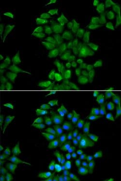 Invitrogen CTNS Polyclonal Antibody 100 &mu;L; Unconjugated:Antibodies,
