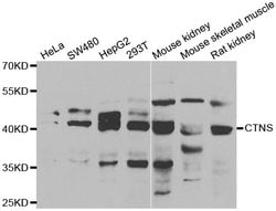 Invitrogen CTNS Polyclonal Antibody 100 &mu;L; Unconjugated:Antibodies,