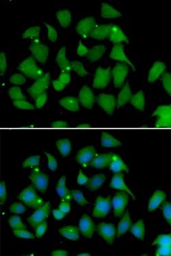Invitrogen FMO1 Polyclonal Antibody 100 &mu;L; Unconjugated:Antibodies,