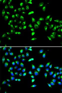 Invitrogen GALNT2 Polyclonal Antibody 100 &mu;L; Unconjugated:Antibodies,