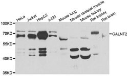 Invitrogen GALNT2 Polyclonal Antibody 100 &mu;L; Unconjugated:Antibodies,