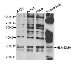 Invitrogen HLA-DMA Polyclonal Antibody 100 &mu;L; Unconjugated:Antibodies,