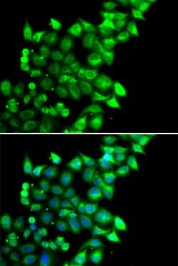 Invitrogen MEST Polyclonal Antibody 100 &mu;L; Unconjugated:Antibodies,