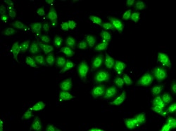 AFF1 Polyclonal Antibody:Antibodies, Polyclonal