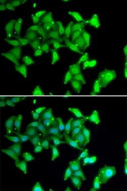MYO1C Polyclonal Antibody:Antibodies, Polyclonal